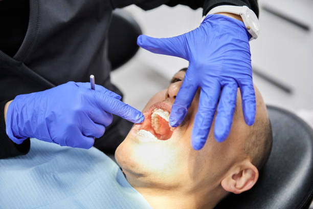 Best Emergency Gum Treatment in College Station, TX
