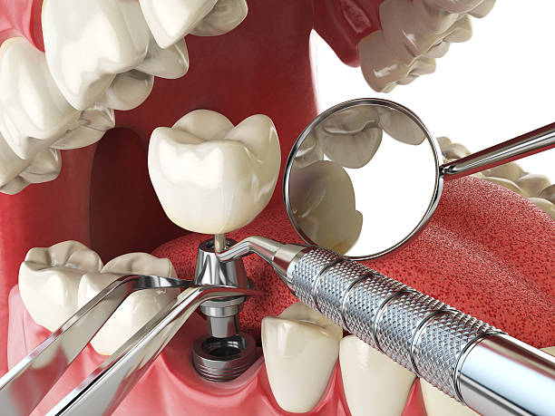 Best Emergency Treatment for Dental Infections or Abscesses in College Station, TX