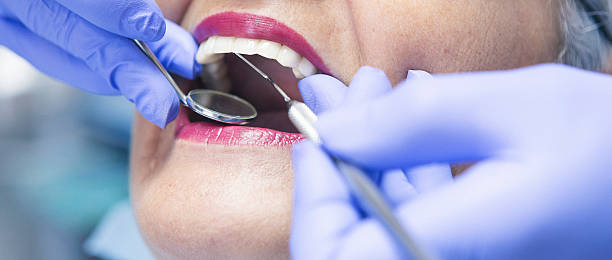 Best Emergency Dental Care for Broken or Chipped Teeth in College Station, TX